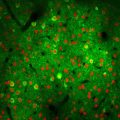 Auditory Cortex